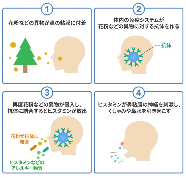 コロナ後の黄色いネバネバ鼻水は治りかけ？副鼻腔炎のサインと受診基準
