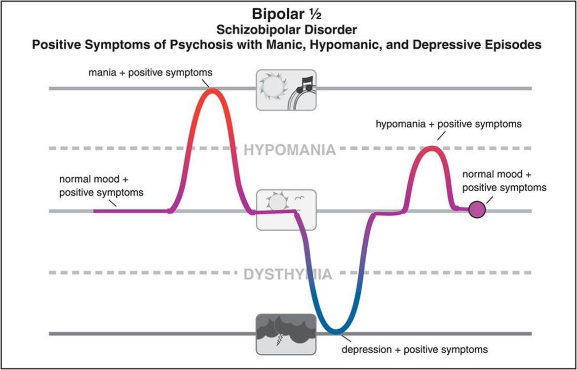 Bipolar with Psychotic Features Symptoms Differ in Manic Versus Depressive Phases
