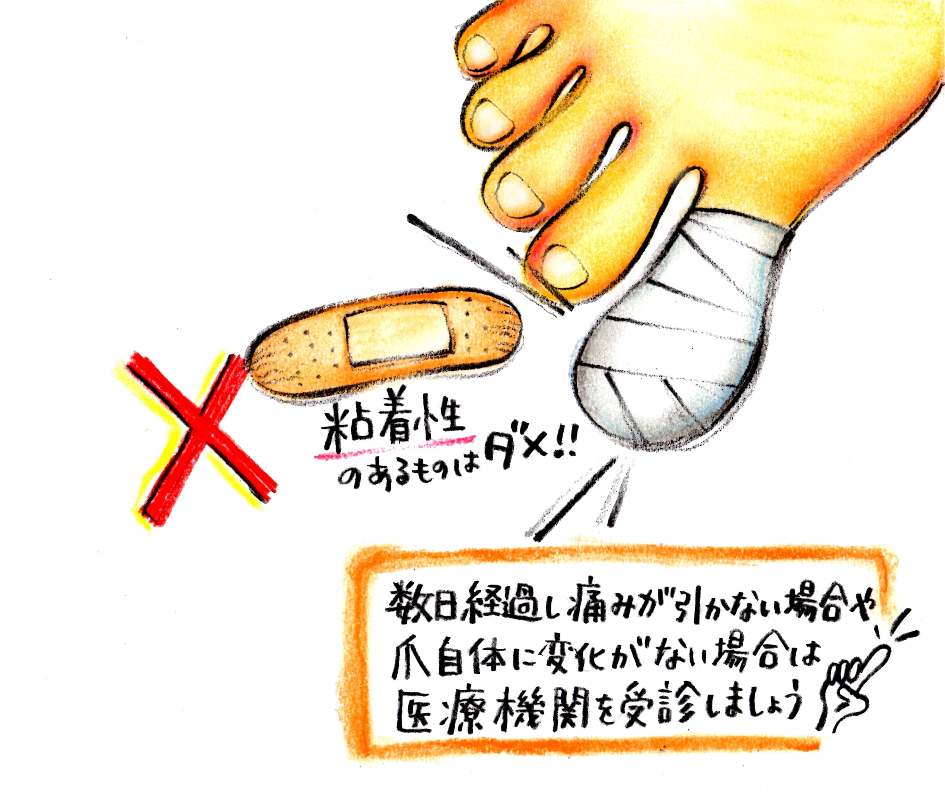爪が剥がれたら消毒Ng！正しい応急処置と受診すべき診療科の完全ガイド