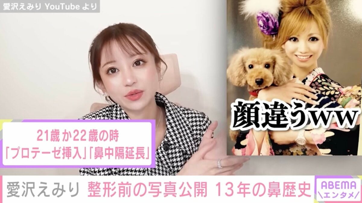 愛沢えみり整形前の真相と現在！公表箇所と美貌の変化を徹底解剖