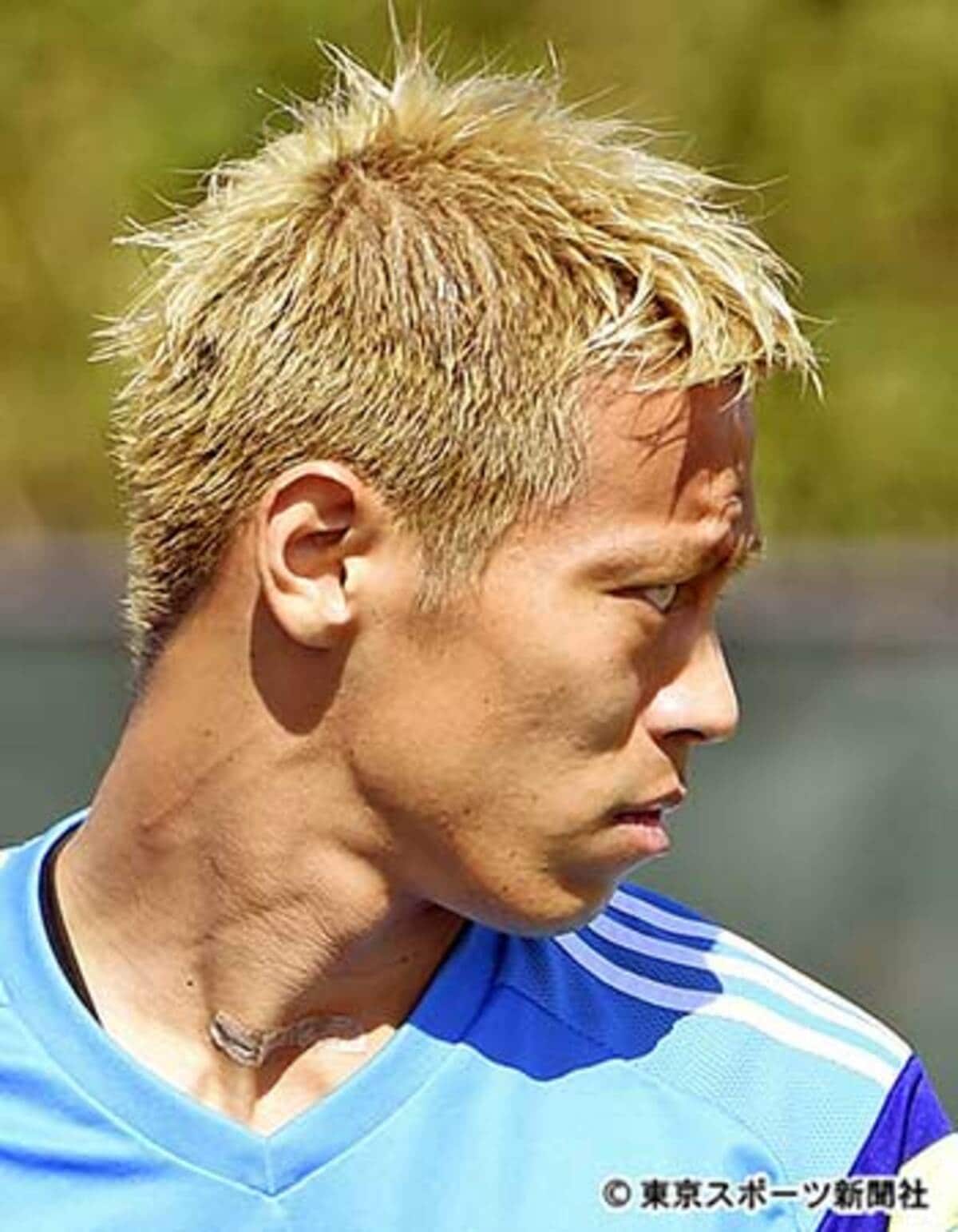 本田の病気説はなぜ浮上？噂される病名と手術・激変の真相【2026】