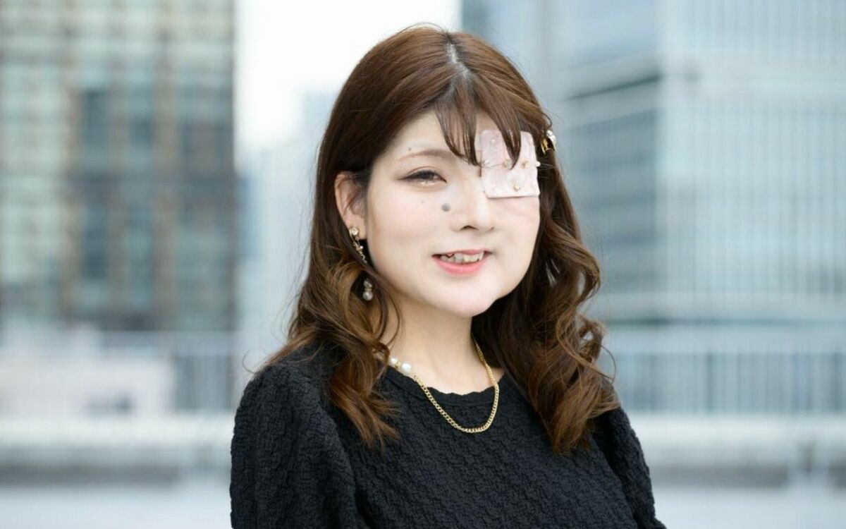 絢香の病気と現在の姿｜水嶋ヒロと歩んだバセドウ病克服と音楽活動