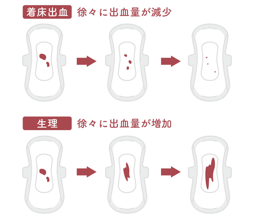 着床出血とは？生理との違いや色・量・時期を徹底解説