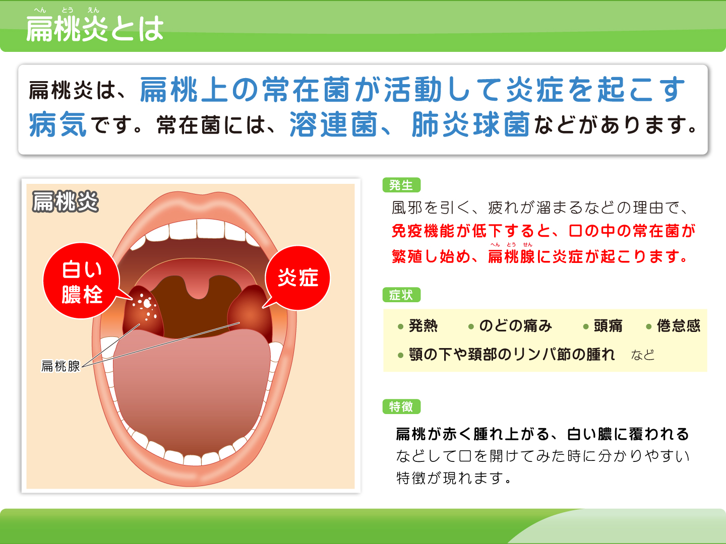 扁桃炎の白い膿はなぜできる？臭い玉との違いや受診の目安を徹底解説