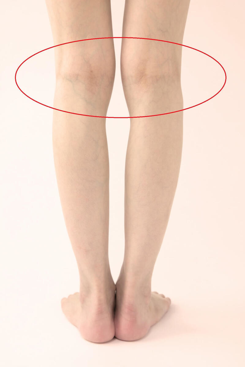 ひかがみの痛みや腫れの正体とは？膝裏の病気とほぐし方を徹底解説