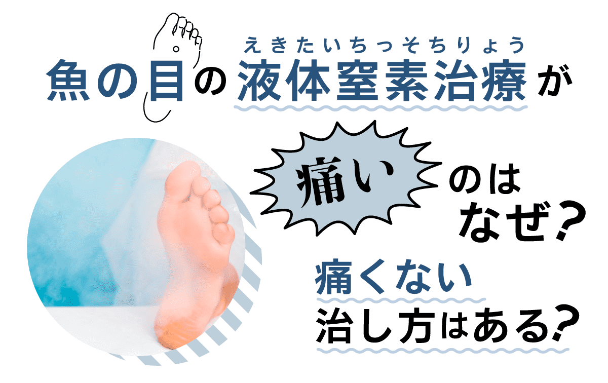 液体窒素のイボ治療はなぜ激痛？痛みのピークと劇的緩和法を徹底解説