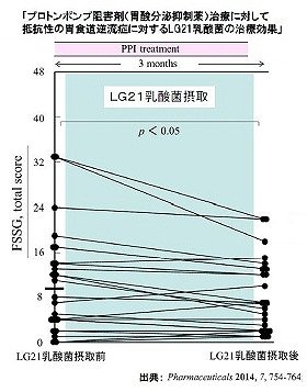【速報】 Lg21 効果 逆流 性 食道 炎 公式インスタ・X最新情報 #628