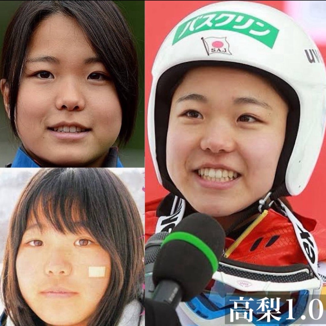 高梨沙羅の顔変わりすぎの真相！すっぴんから現在2026年の軌跡
