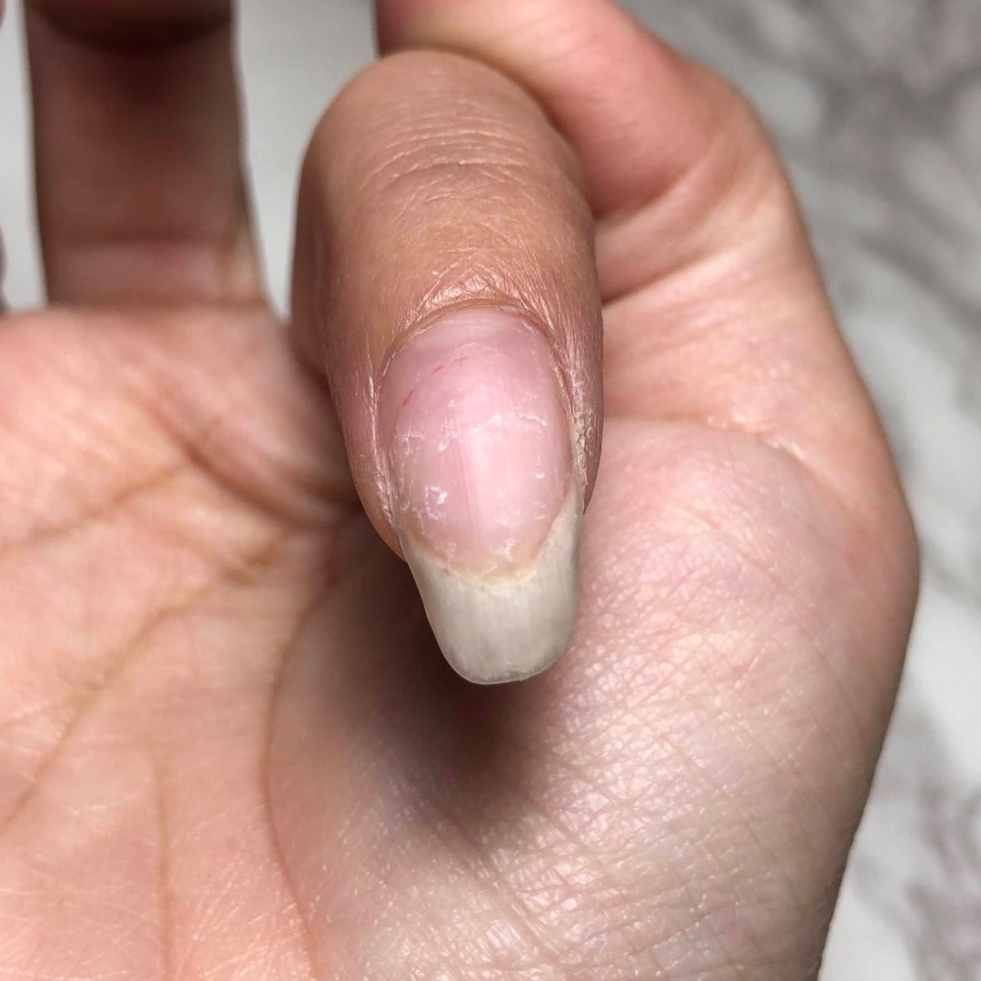 薄くなった爪の原因と修復法｜戻る期間とプロ直伝の最新育爪ケア