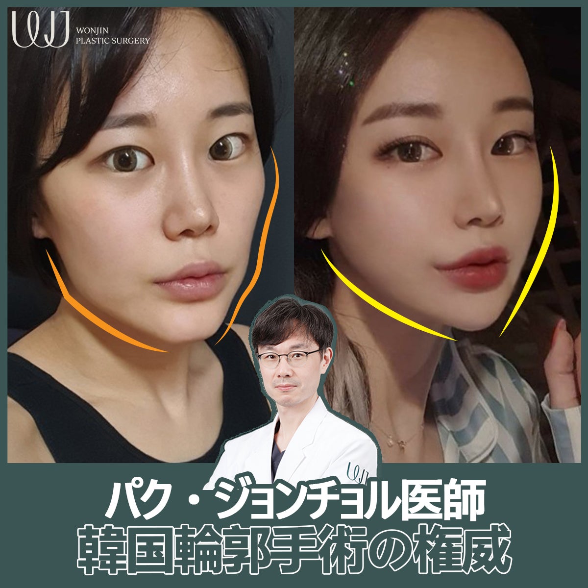 韓国プチ整形の最前線！費用相場と名医選びの裏側を現地徹底取材