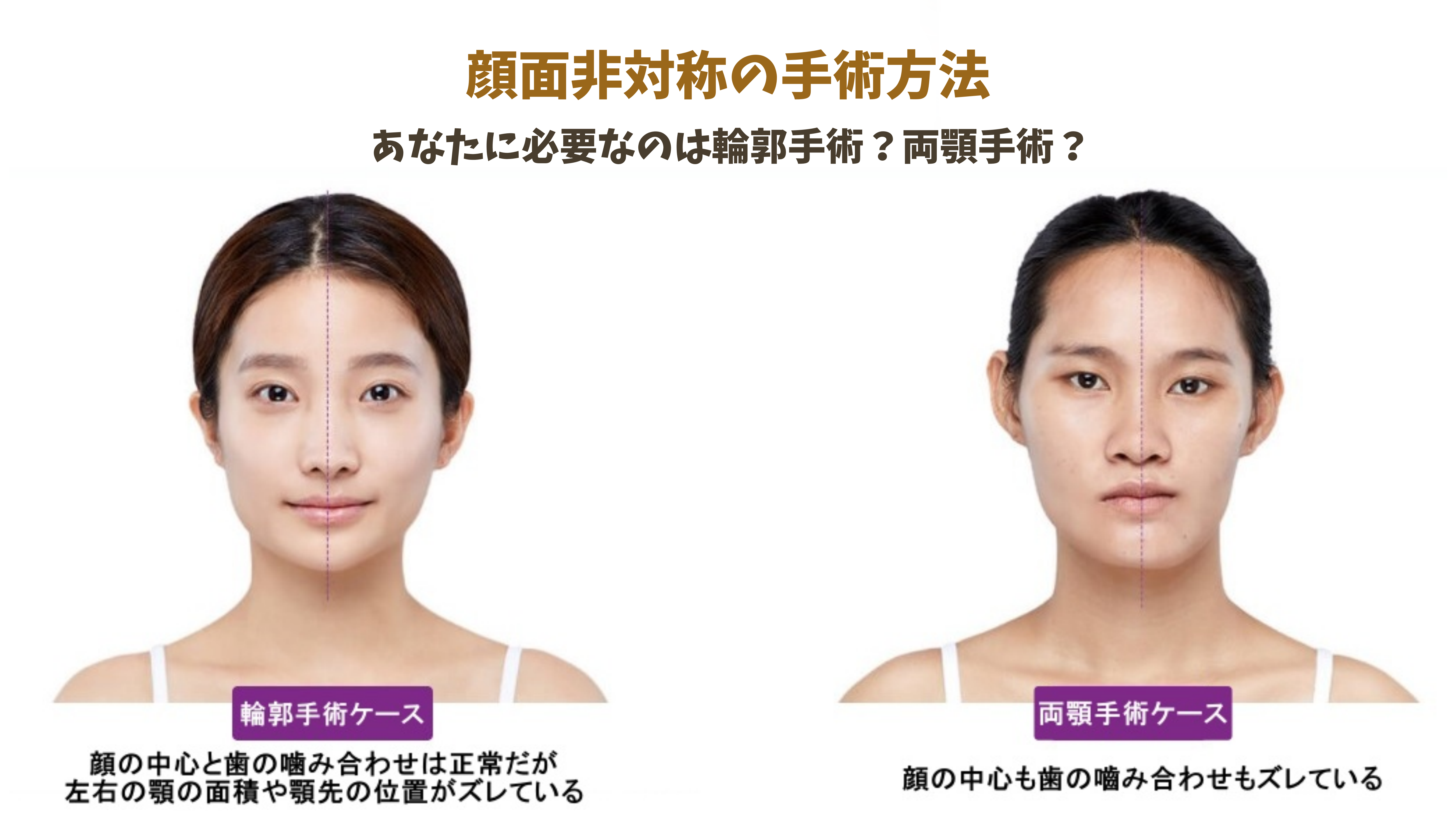 顔の歪みはどう治す？左右非対称の根本原因と輪郭を整える最新医学