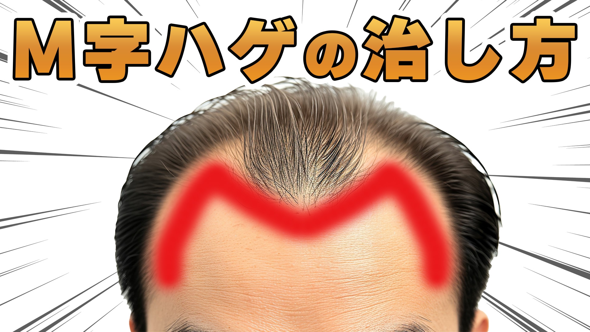 ハゲたら坊主は本当に正解？似合うミリ数と頭の形別スタイリング術