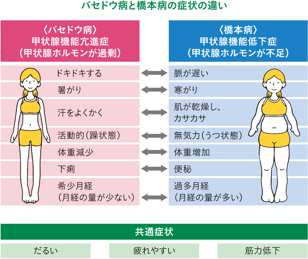 甲状腺の腫れはストレスが原因？首の違和感の正体と受診目安【2026年最新】