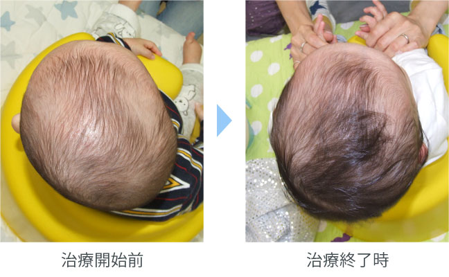 【2026年最新ガイド】「赤ちゃんが頭から落ちた」その瞬間、親が最初に取るべき行動と受診の判断基準とは