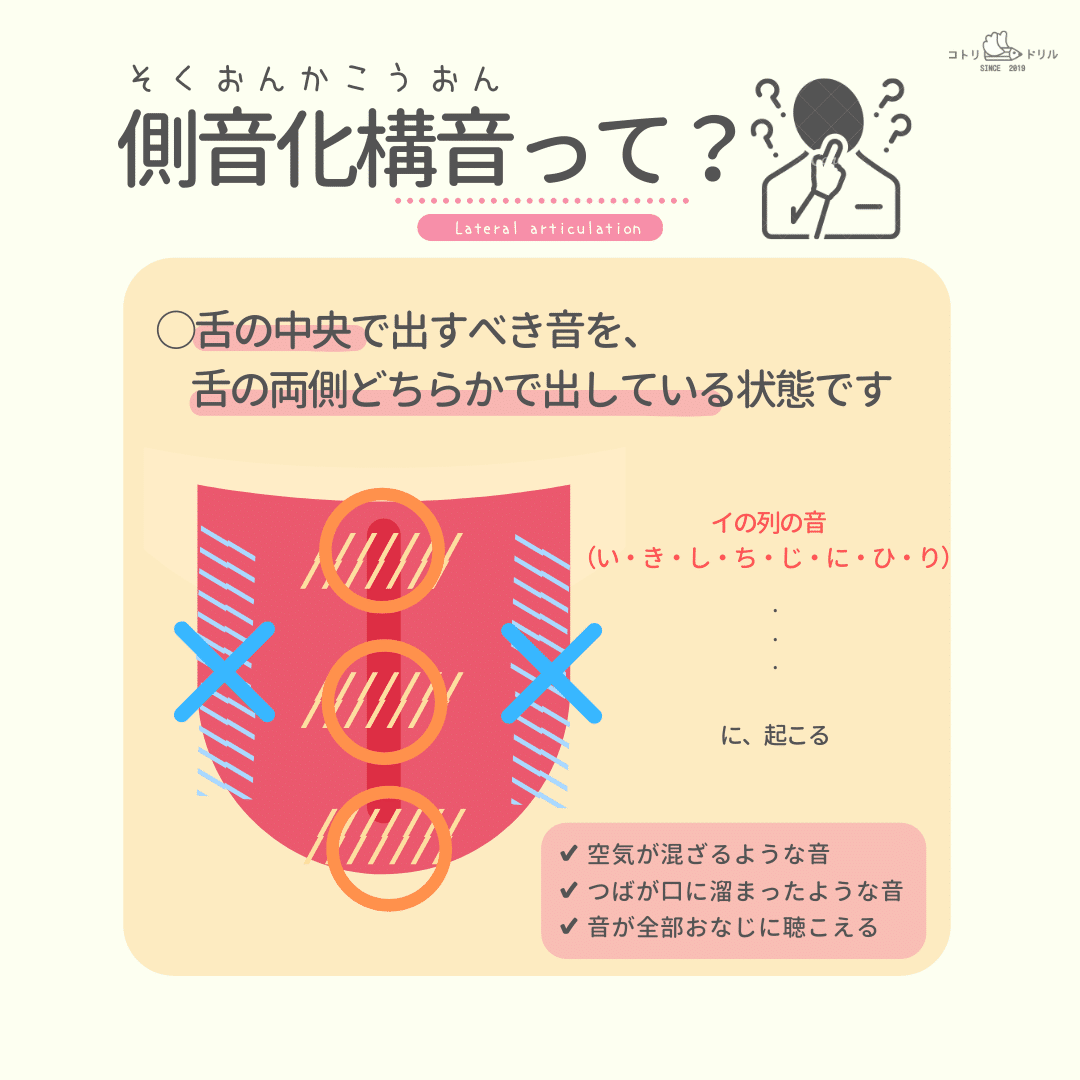 側音化構音は自然に治る？原因と治し方を言語聴覚士が徹底解説【2026】