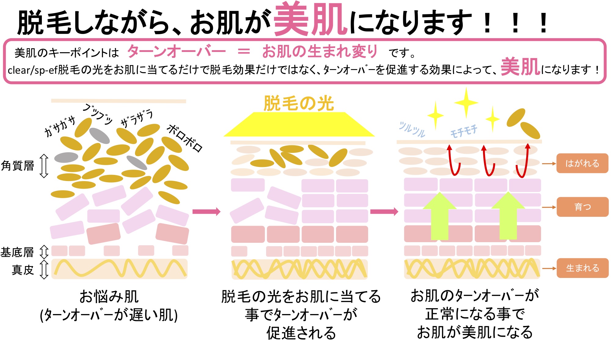 光フェイシャルとは？効果やレーザーとの違い・失敗しない全知識