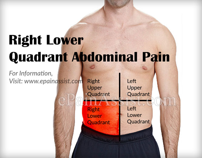 Pain Lower Right Stomach Area