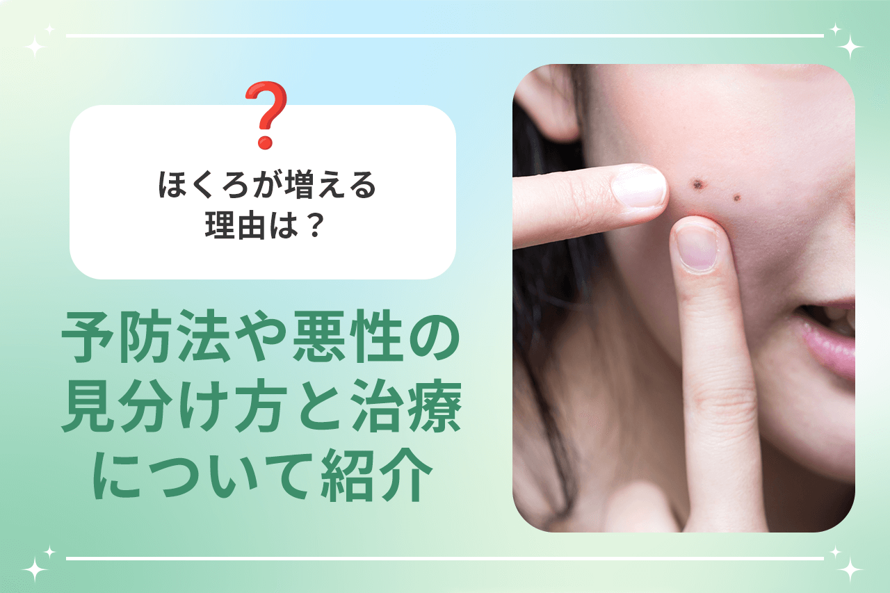 急にホクロが増える理由とは？メラノーマの見分け方と皮膚科受診の目安