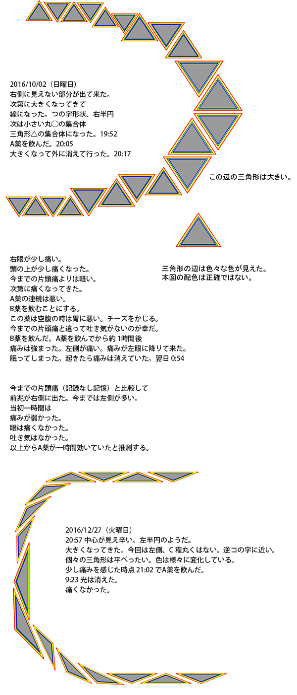 目の前がギザギザ光る閃輝暗点と頭痛！原因・危険な病気と最新対処法