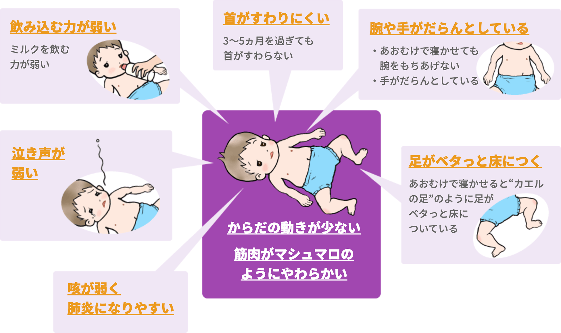 赤ちゃんの低緊張とは？見逃せないサインと原因・療育支援を徹底解説