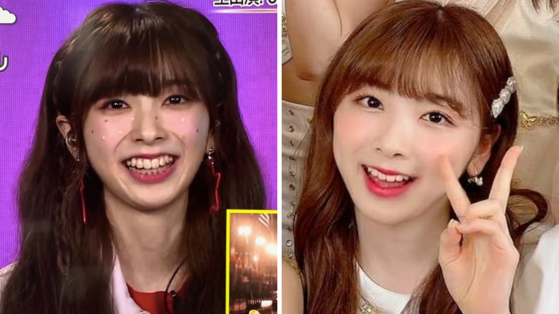 ほうれい線があっても可愛い芸能人！老け見えしない理由と愛され顔の条件