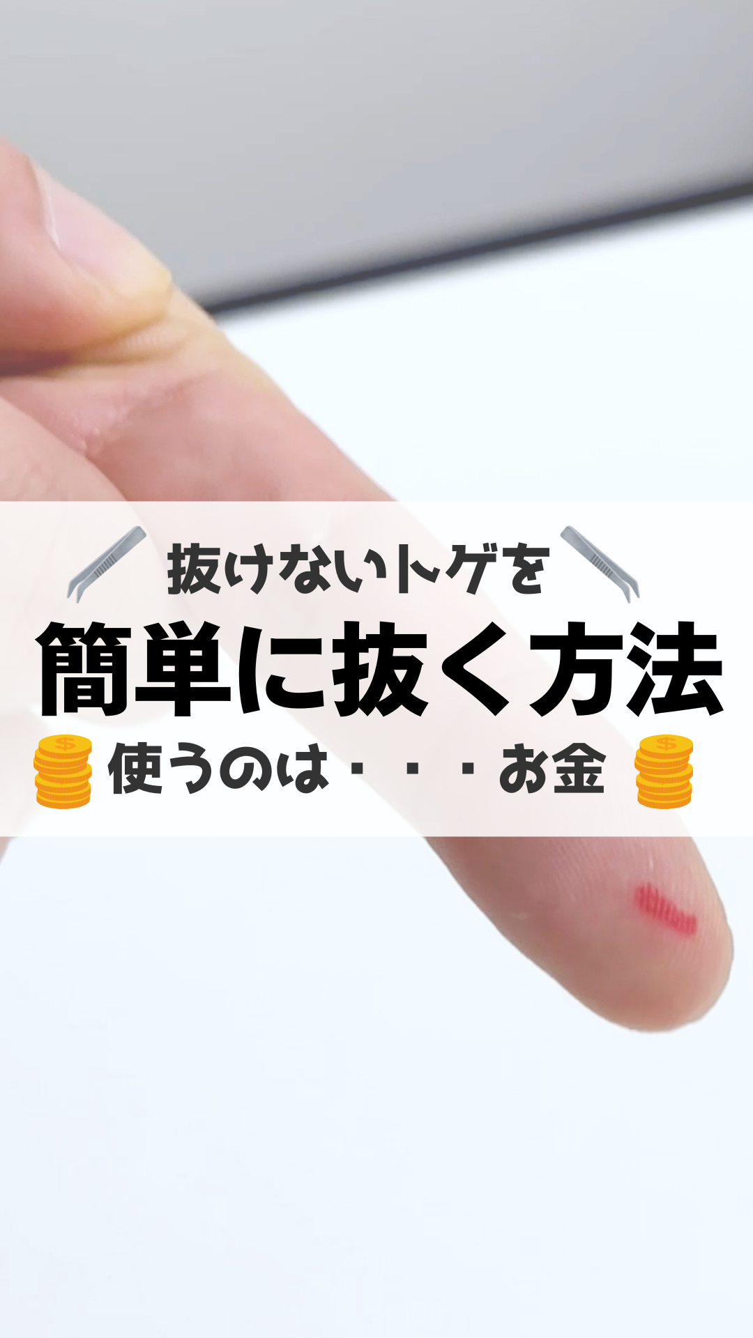 痛くないとげの抜き方｜5円玉やテープの裏ワザと深く刺さった時の対処法
