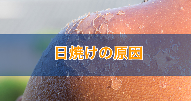 日焼けの皮むけは剥がすと危険？跡を残さず早く治す最新肌ケア術