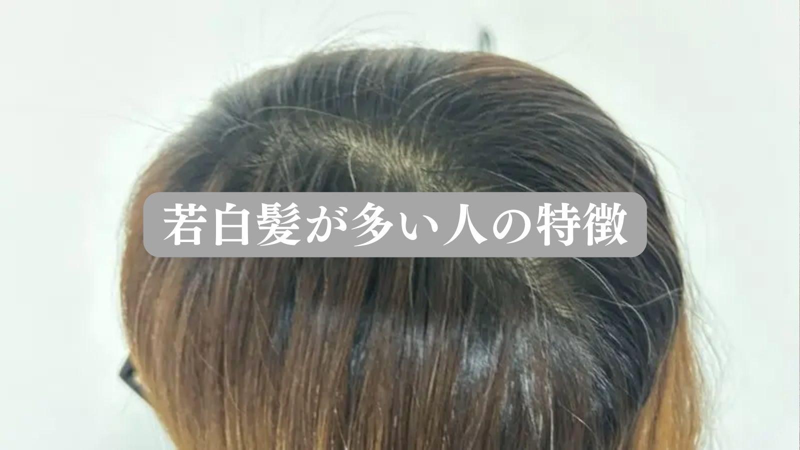 若白髪が多い人の特徴と原因｜10代20代で目立つ真相と改善策
