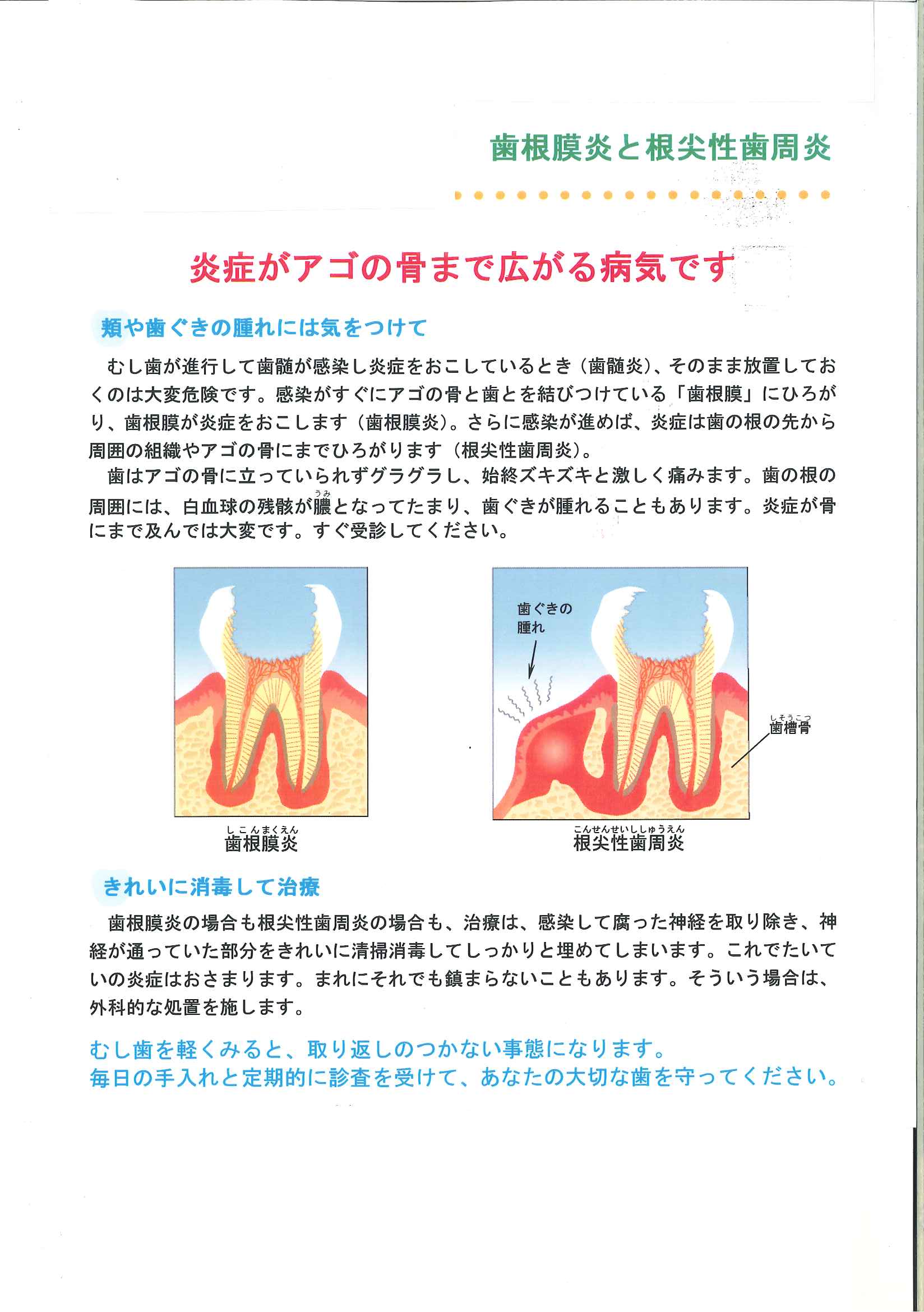 歯根膜炎で噛むと痛い真相！自然治癒の誤解と抜歯リスクを徹底解明