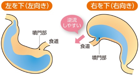 「右を下にして寝ると胃酸が逆流する」は本当か？最新の消化器医学が導き出した「食後の正しい姿勢」の最適解