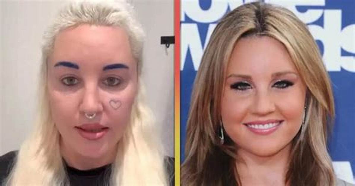Amanda Bynes Mental Health Diagnosis, History of Depression and Anxiety – Is She in Psychiatric Hold?