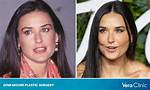 Demi Moore Spent a Fortune on Plastic Surgery