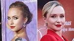 Did Hayden Panettiere Get Plastic Surgery: Before & After!