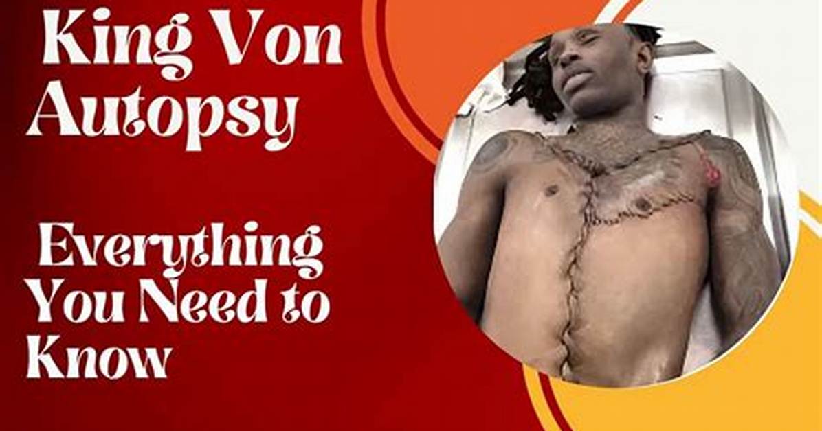Discover the Secrets of King Vin Autopsy: Unlocking Vehicle History