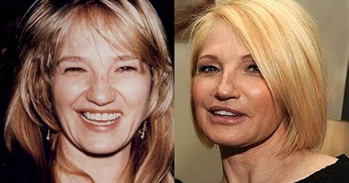 Ellen Barkin Weight Loss Before and After | Illness and Health 2023