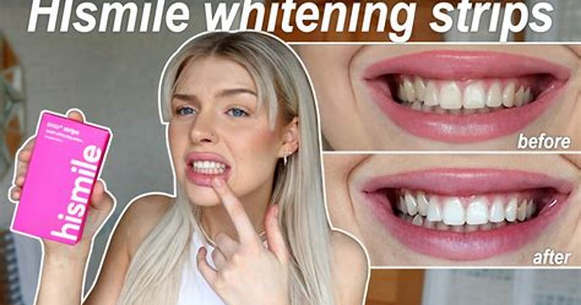 Hismile Reviews: Our Honest Hismile Teeth Whitening Thoughts
