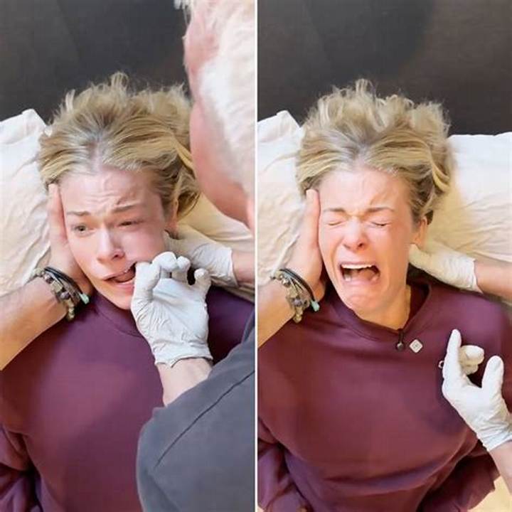 Leann Rimes Deep Jaw Release: What It Is, How It’s Done, and Safety