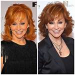 Reba Mcentire's Plastic Surgery Rumors Revealed