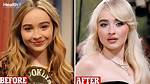 Sabrina Carpenter: Before and After Plastic Surgery - Unfiltered Truths Revealed