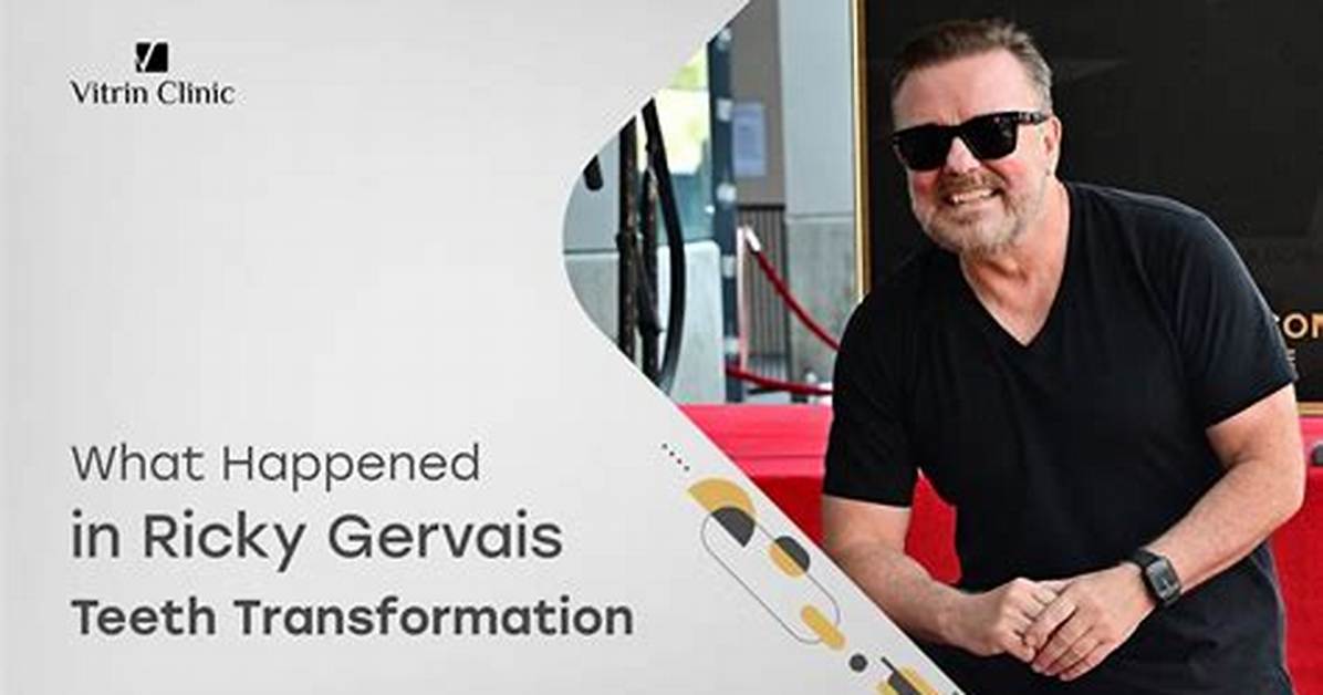 The Surprising Truth Behind Ricky Gervais's Fortune
