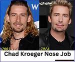Unveiling the Life of Chad Kroeger's Brother: a Deep Dive