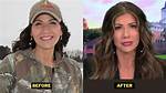 Unveiling the Transformation: Keisti Noem Plastic Surgery Journey