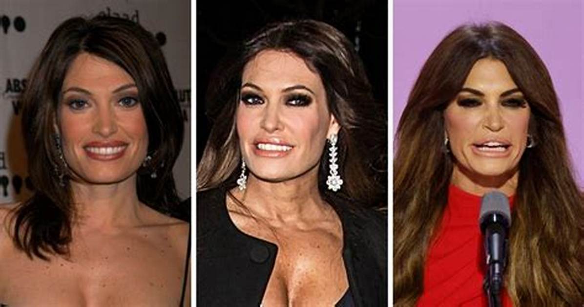 Unveiling the Transformation: Kimberly Guifoyle and Her Journey Through Plastic Surgery