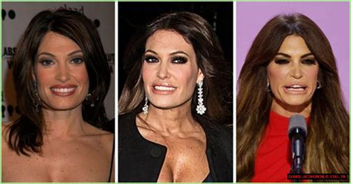 Unveiling the Transformation: Kimberly Guilfoyle's Face Before and After