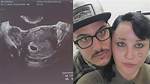 Unveiling the Truth: Is Amanda Bynes Pregnant with Dan?