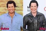 Wayne Newton's Plastic Surgery Journey