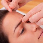Why-Latinos-Should-Try-Acupuncture-MainPhoto