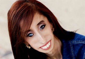 Lizzie Velasquez Rises Above Bullying - Mamiverse