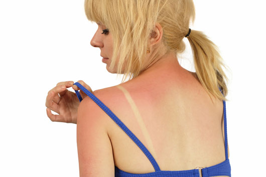 15-Myths-about-Sunscreen-that-Need-to-be-Smeared-photo6