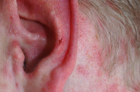 15 auditory Illnesses You’ve Never Heard Of-Photo1